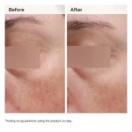 Niacinamide 5% Face and Body Emulsion - Image 2