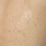 Salicylic Acid 0.5% Body Serum - Image 2