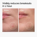 Sulfur 10% Powder-to-Cream Concentrate - Image 3